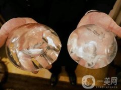 曼托假體和麥格假體哪種手感更好？教你怎么選擇？