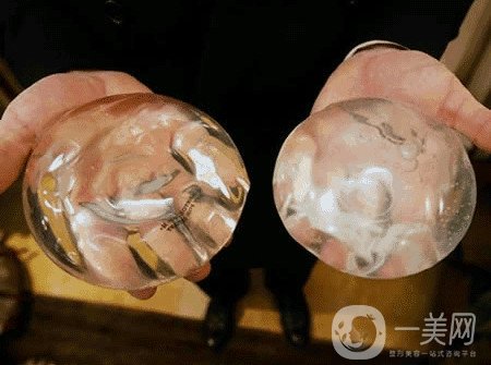 曼托假體和麥格假體哪種手感更好？教你怎么選擇？