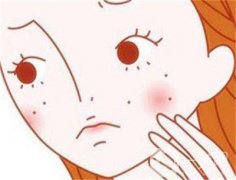 激光祛斑祛痘好不好？要調(diào)節(jié)多少次？