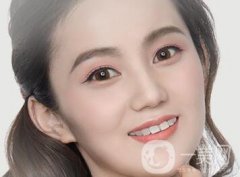 歪鼻矯正注意事項(xiàng)說(shuō)明?包括術(shù)前術(shù)后哦