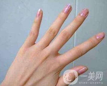 怎樣去掉手上的老年斑？還會(huì)再生嗎？