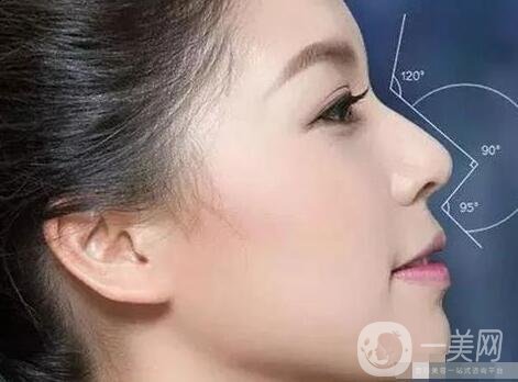 *多久才能笑自然?恢復期要多久?