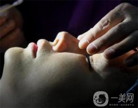 硅膠隆鼻能保持多久？可以終身保持嗎？