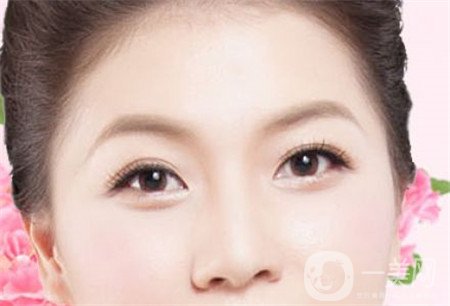 韓式開眼角多少錢？普遍價(jià)位是多少？