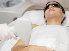 激光脫毛好嗎？有副作用嗎？