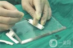 膨體隆鼻缺點(diǎn)是什么？?jī)?yōu)點(diǎn)有哪些？