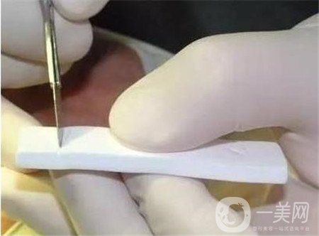 膨體隆鼻術(shù)后注意事項有哪些？需要忌口嗎？