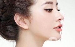 自體脂肪填充下巴醫(yī)生哪些做得比較好?