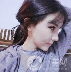 自體脂肪填充