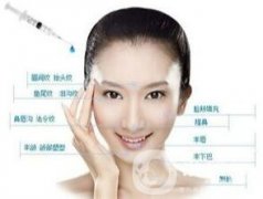 自體脂肪填充抬頭紋維持時間是多久?