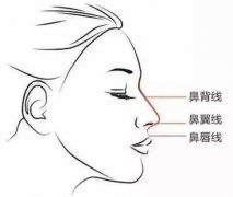 硅膠隆鼻一定會下滑嗎?下滑了怎么辦?