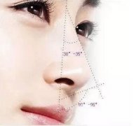 第二次隆鼻多久修復一般用什么材料?