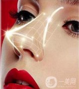 鼻部整形費(fèi)用大概需要多少錢(qián)?包括哪些項(xiàng)目?