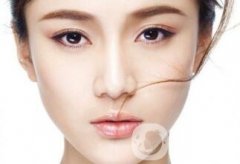 假體隆鼻果怎么樣呢？是否自然？