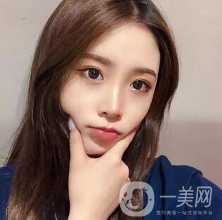假體隆鼻整形手術(shù)一般多少錢？