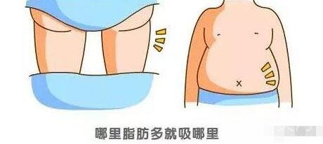 自體脂肪填充副作用及后遺癥是什么?