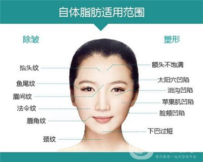 北京自體脂肪填充醫(yī)院有哪些？好的有哪些？
