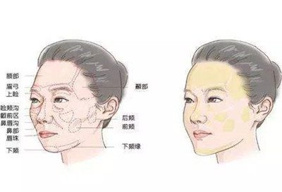 北京自體脂肪填充醫(yī)院有哪些？好的有哪些？