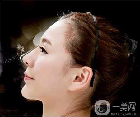 假體隆鼻術(shù)價格大概是多少？求告知