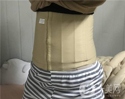 腰腹環(huán)吸后要腫多長(zhǎng)時(shí)間呢？可以活動(dòng)嗎？