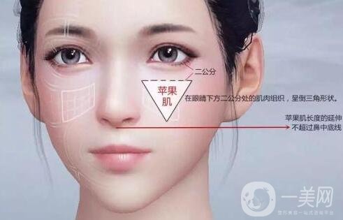 注射填充蘋果肌之后能笑嗎?會(huì)僵硬嗎?