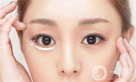 眼部提升手術(shù)怎么做？多久恢復(fù)？