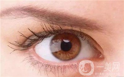  眼部整形費(fèi)用貴嗎？怎么收費(fèi)區(qū)別那么大？