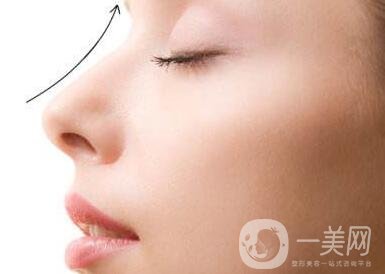 北京整容墊鼻梁多少錢(qián)？附隆鼻價(jià)格明細(xì)一覽表