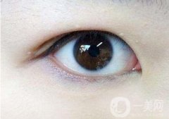 內(nèi)雙怎么變外雙？能貼雙眼皮貼嗎？