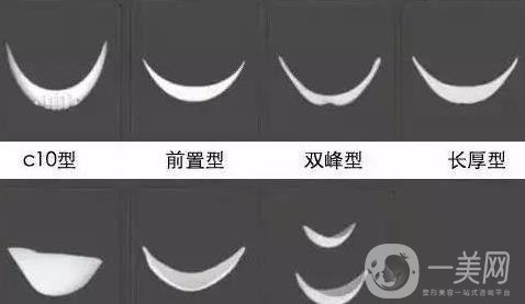 膨體隆下巴多久會變軟？容易取出來嗎？