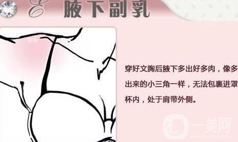 腋下副乳手術(shù)的價格是多少?影響因素有哪些呢?