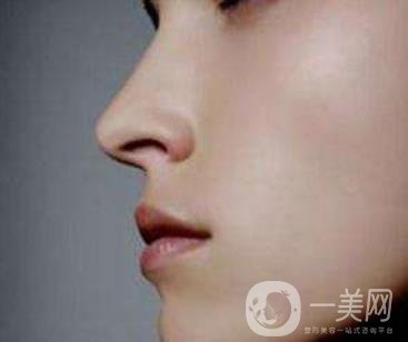 鼻尖美容術(shù)方法介紹詳情一覽