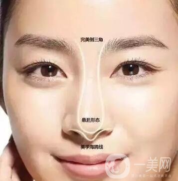隆鼻手術(shù)怎么做？操作過程解析
