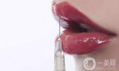 玻尿酸豐唇術(shù)后要注意些什么？