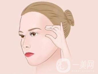 小切口除皺術(shù)后恢復(fù)過程是怎樣的？