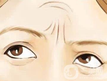 抬頭紋怎么去除？?jī)r(jià)格是多少呢？