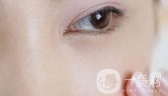 玻尿酸豐淚溝有危險(xiǎn)嗎？能管多久？