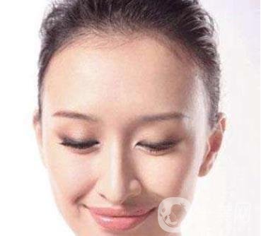 隆額頭材料哪種比較好？要多少錢？
