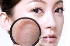 激光收毛孔多少錢?貴嗎?