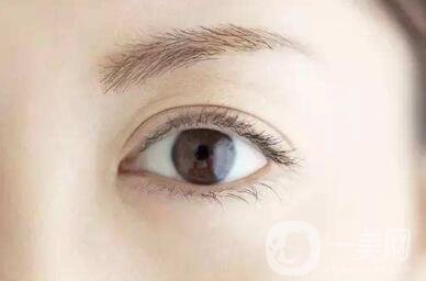 開眼角好嗎？*果怎么樣？