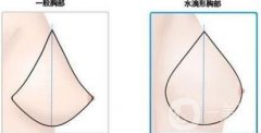 水滴型乳房做出來后自然嗎?和圓形比哪種自然些?