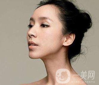 骨粉隆鼻后遺癥是什么樣的？