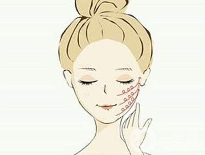 磨下頜角價(jià)格是不是很貴？一般要多少錢？