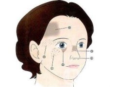 祛斑手術(shù)價格貴不貴？要多少錢？