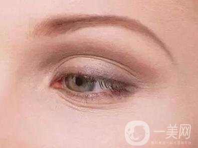 去除魚尾紋的方法有哪些？哪種方法比較好？