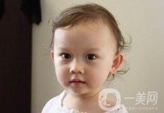 去頰脂墊價格貴嗎？大概價位是多少？