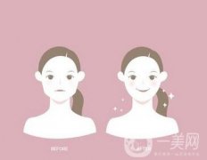 去頰脂墊有副作用嗎？術(shù)后如何護(hù)理可以減小副作用？