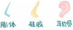 隆鼻手術(shù)有幾種方式?哪種方式比較大眾化?