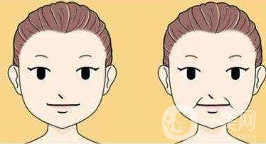 冰電波拉皮除皺*果如何？有哪些優(yōu)點(diǎn)？