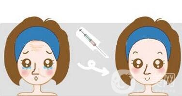 玻尿酸保持時間是多久？如何延長保持時間？